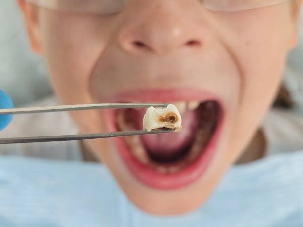, RI Emergency Dentist Company